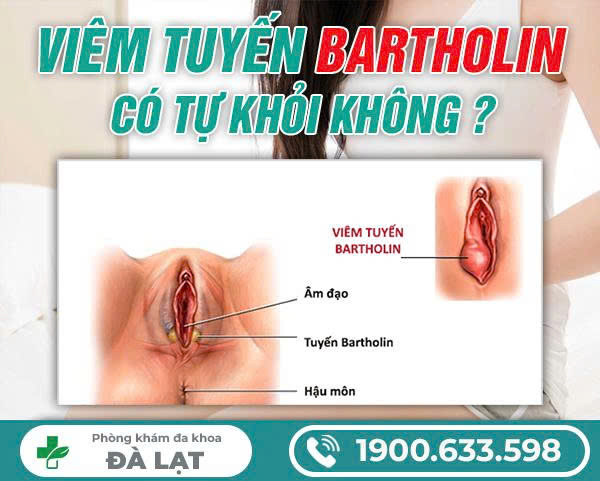 Hình ảnh minh họa